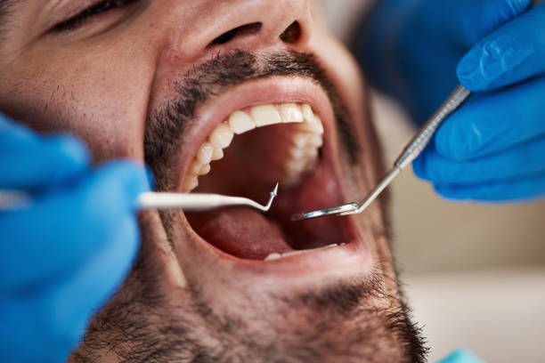 Best Emergency Treatment for Oral Infections in Oil City, PA